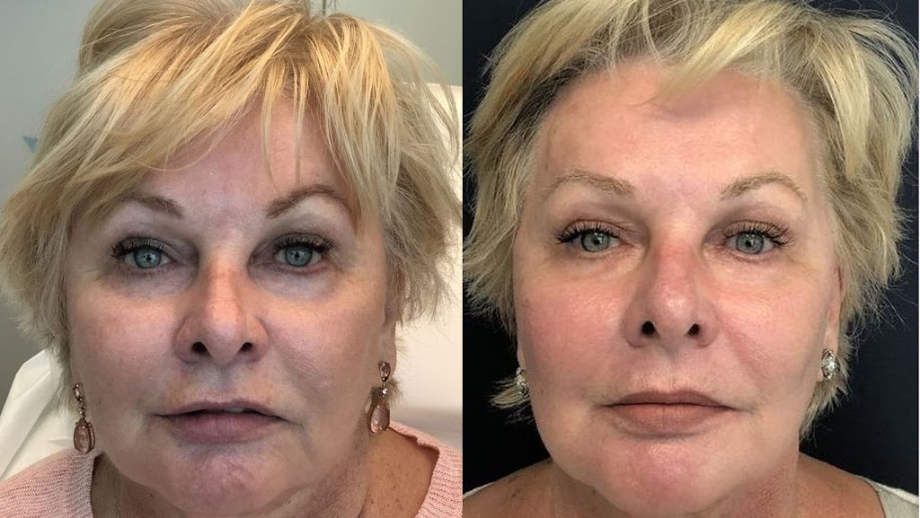 White Rock Skin and Laser Clinic | 15850 26 Ave #101, Surrey, BC V3Z 2N6, Canada | Phone: (778) 545-1925