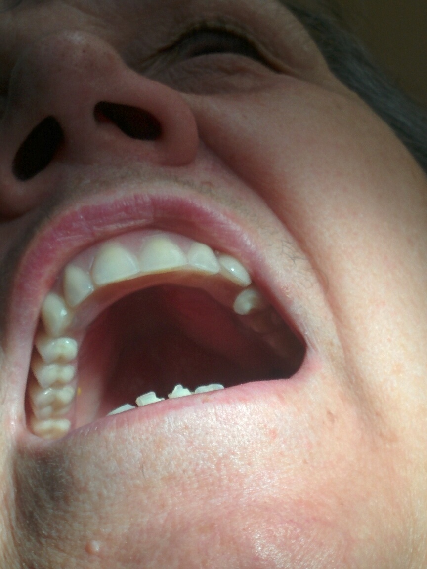 Lima Denture and Implant Solutions | 1580 Merivale Rd Unit 16, Nepean, ON K2G 4B5, Canada | Phone: (613) 224-1001
