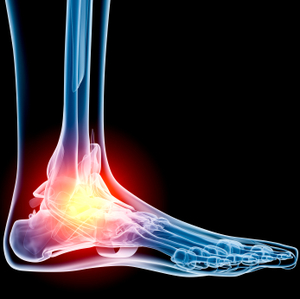 Tsawwassen Podiatrist Dr. Dixon | 218- BC V4L 2A2, 1077 56 St, Delta, BC V4L 2A2, Canada | Phone: (604) 943-4405