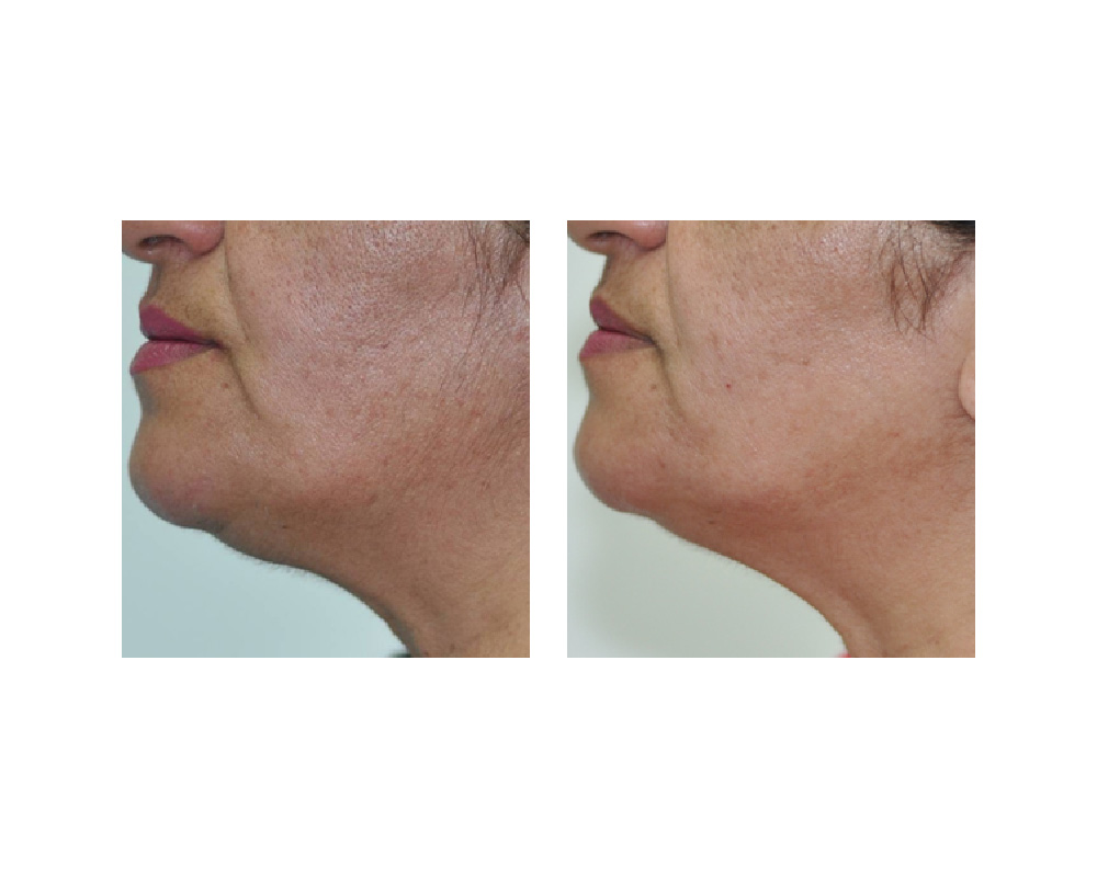 Laser And Lash Clinic | 633 King St E unit# 206, Oshawa, ON L1H 1G3, Canada | Phone: (416) 896-5274