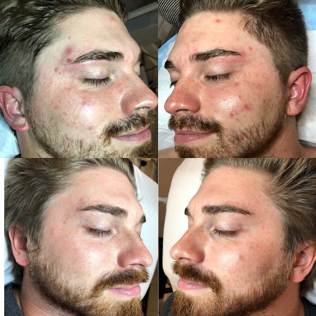 Vanity Skin Clinic | 321 Ravenswood Way, Ottawa, ON K4A 0R9, Canada | Phone: (613) 290-7026