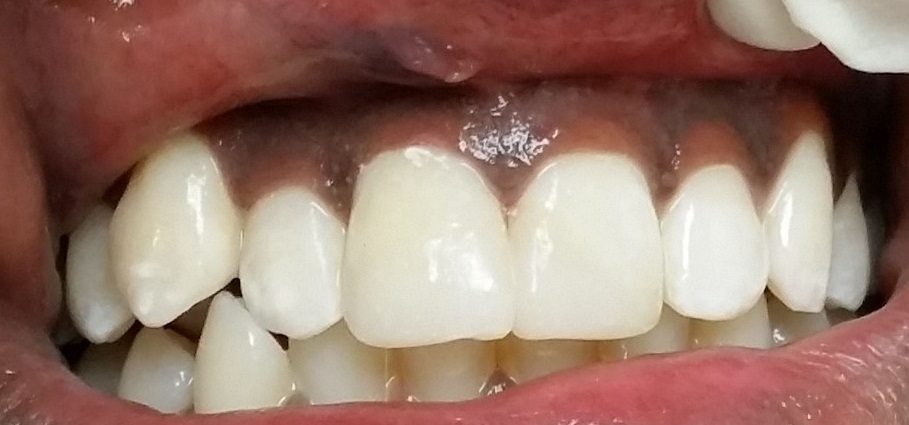Kenedy Ruth Dental Centre | 27 Ruth Ave, Brampton, ON L6Z 4R2, Canada | Phone: (905) 846-1595
