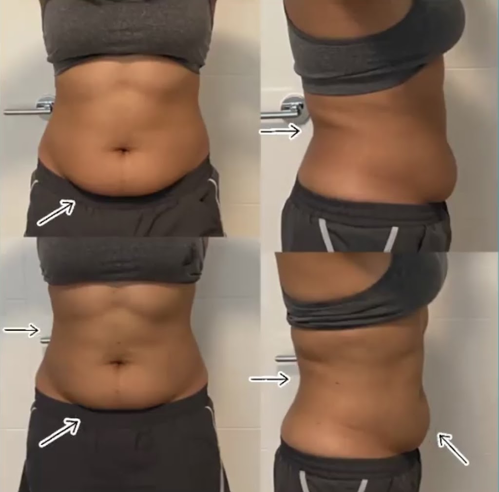 Precise Body Lab | 31125 Kingfisher Dr, Abbotsford, BC V2T 5K4, Canada | Phone: (778) 345-5345