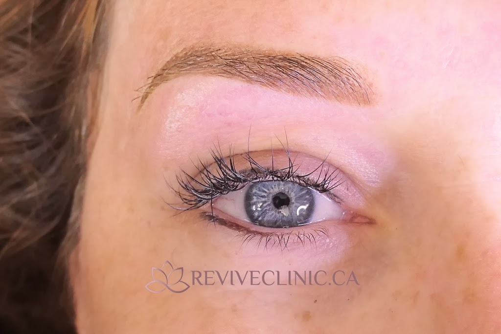 Revive Clinic Cosmetic Tattooing | 106 Wellman Crescent, Saskatoon, SK S7T 0J1, Canada | Phone: (306) 262-3282