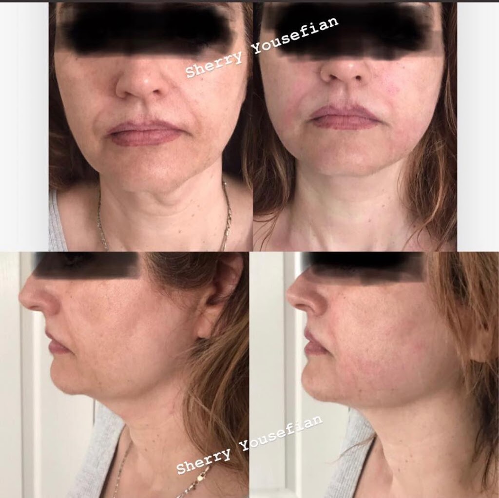 Medic laser and Skin care | 1296 Pacific Blvd, Vancouver, BC V6Z 2V1, Canada | Phone: (604) 633-2474