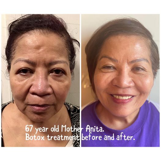 Cylohni Beauty Medical Aesthetics | 7101 50 Ave #100, Red Deer, AB T4N 4E4, Canada | Phone: (403) 588-7796