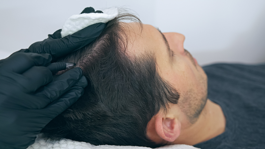 Micropigmentation Rive-Sud | 310 Boulevard Yvon-LHeureux N, Beloeil, QC J3G 5P2, Canada | Phone: (514) 714-6163