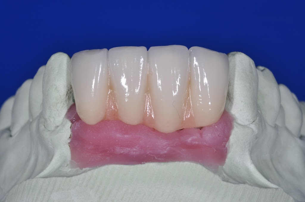 Cad Crowns Ca Inc | 210-1580 Merivale Rd, Nepean, ON K2G 4B5, Canada | Phone: (613) 723-7300