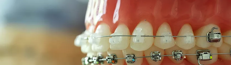 Dental Clinic Dr.Mansouri | 260 Boulevard Saint-Raymond #202, Gatineau, QC J9A 3G7, Canada | Phone: (819) 595-3444