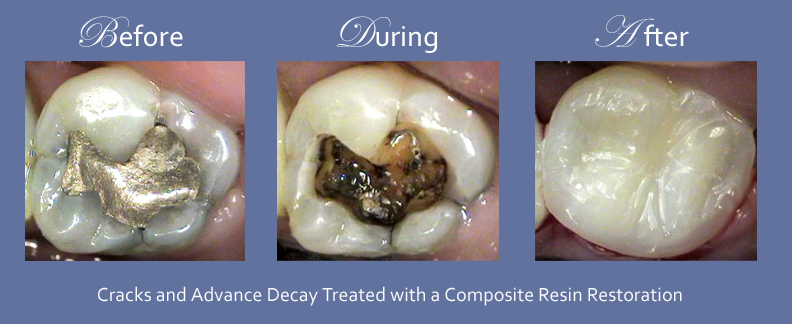 Westmount Dental | 8010 Bathurst St c4, Thornhill, ON L4J 0B8, Canada | Phone: (905) 881-8284