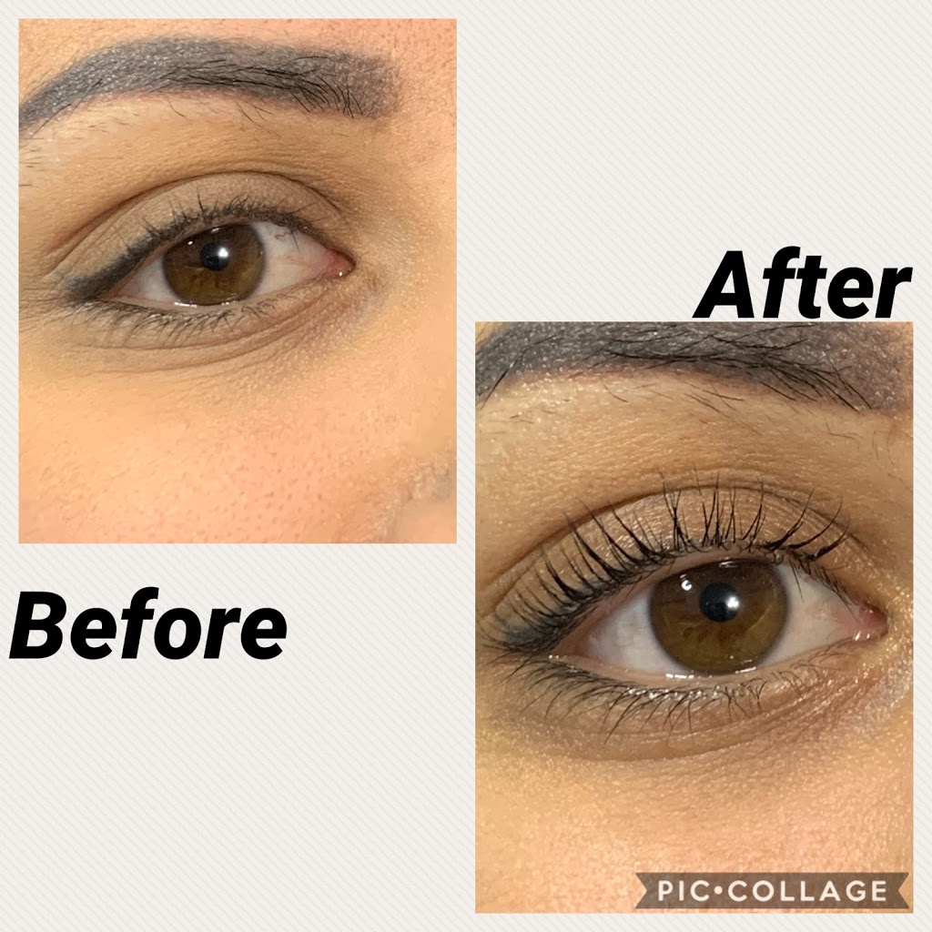 LaserHaven & Beauty | 2480 Strandherd Dr, Nepean, ON K2G 4S4, Canada | Phone: (613) 265-6932