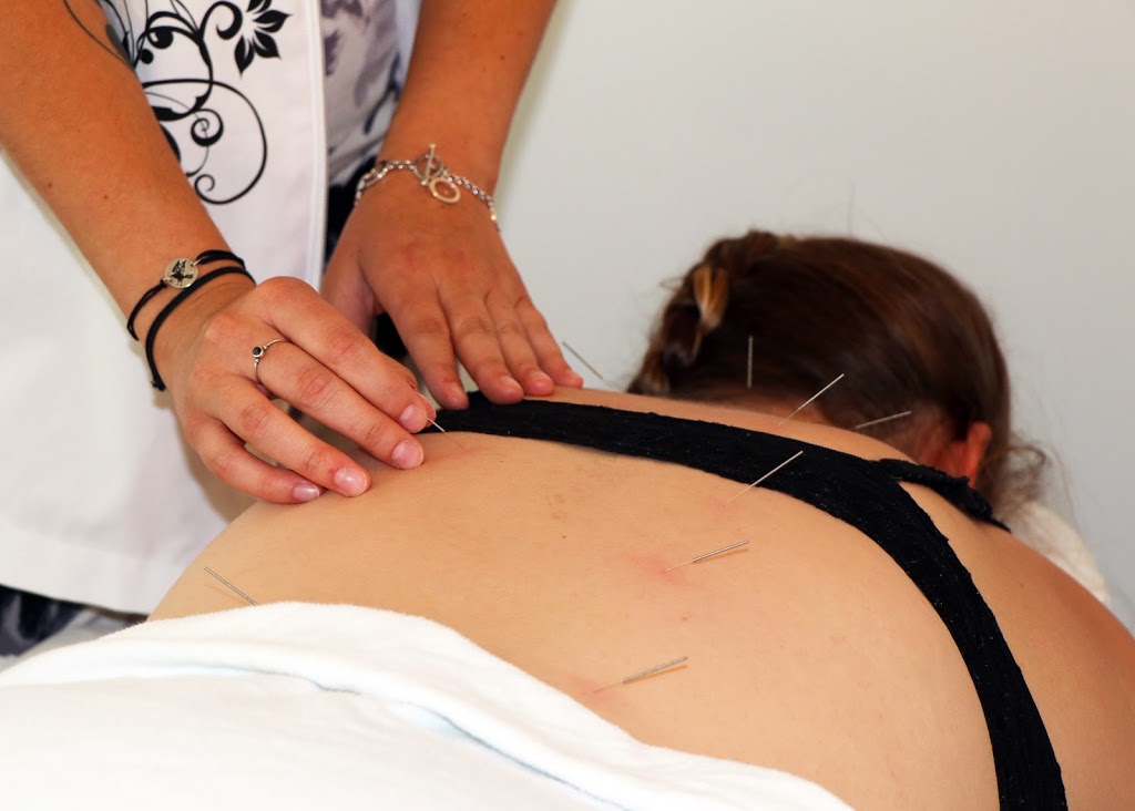 Clinique Réseau Force-Santé Acupuncture | Clinique Réseau Force-Santé, 1100 Boulevard de la Chaudière local 124, Québec, QC G1Y 3L2, Canada | Phone: (418) 353-6590