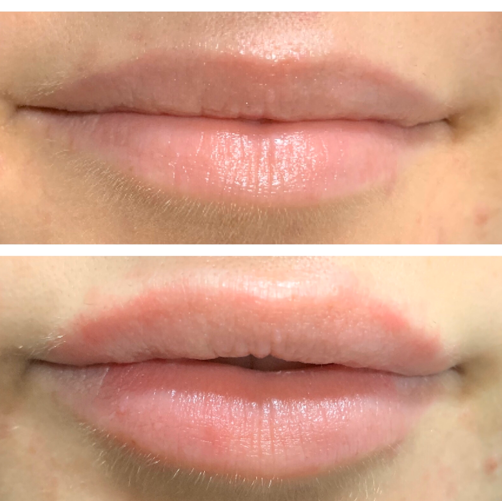 Triniti Laser Clinic & Medi Spa | 210 6th St, New Westminster, BC V3L 3A2, Canada | Phone: (604) 544-5666