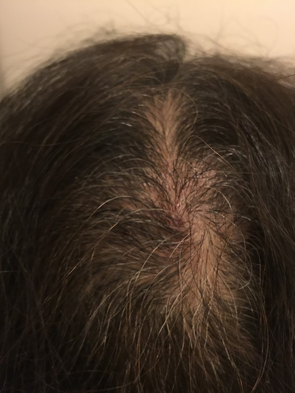 Dr.Yu Acupuncture Clinic | 2661 E Hastings St #1, Vancouver, BC V5K 1Z5, Canada | Phone: (604) 336-1696
