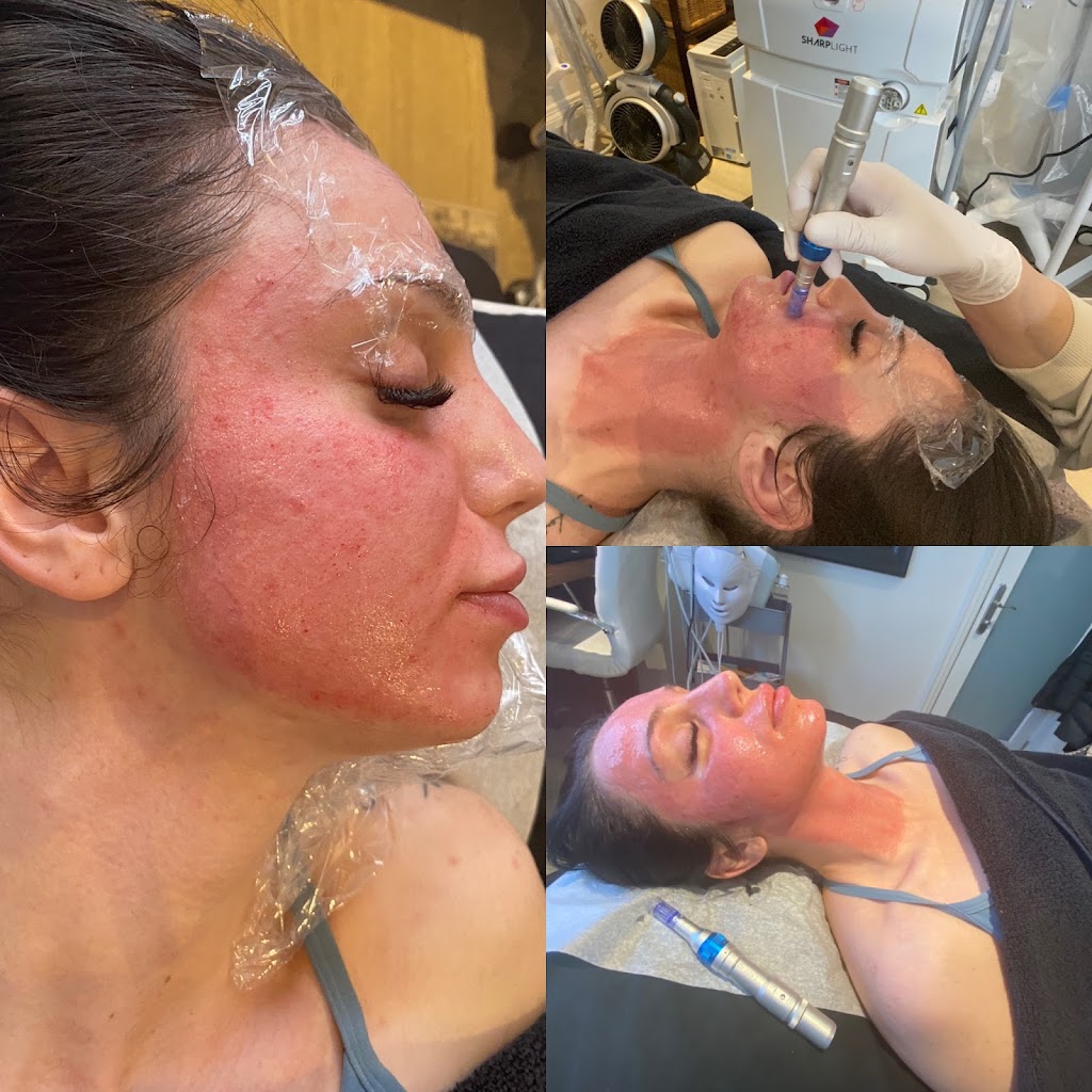 Universal Laser Treatments Inc | 16 Longhouse St, Vaughan, ON L4L 4Z3, Canada | Phone: (647) 278-2211
