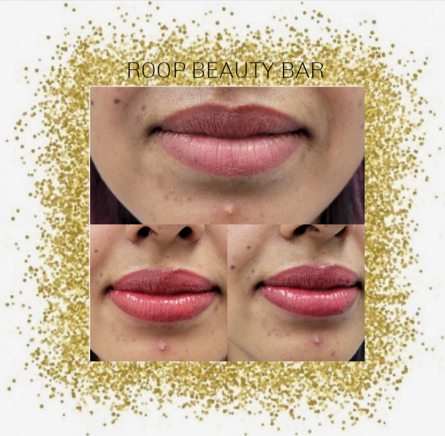ROOP BEAUTY BAR | 410 Baseline Rd #100, Sherwood Park, AB T8H 2A7, Canada | Phone: (780) 464-5400