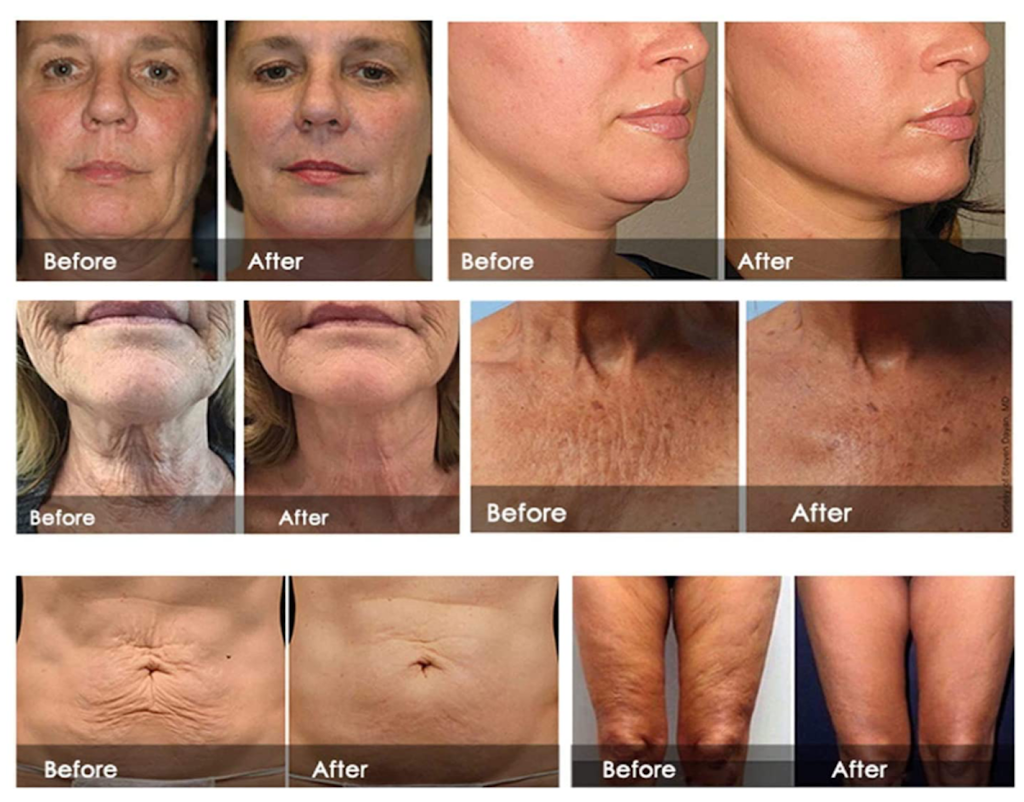 My Secret Garden Spa/Clinic | 338 Aberdeen Blvd, Midland, ON L4R 5M9, Canada | Phone: (705) 427-2699