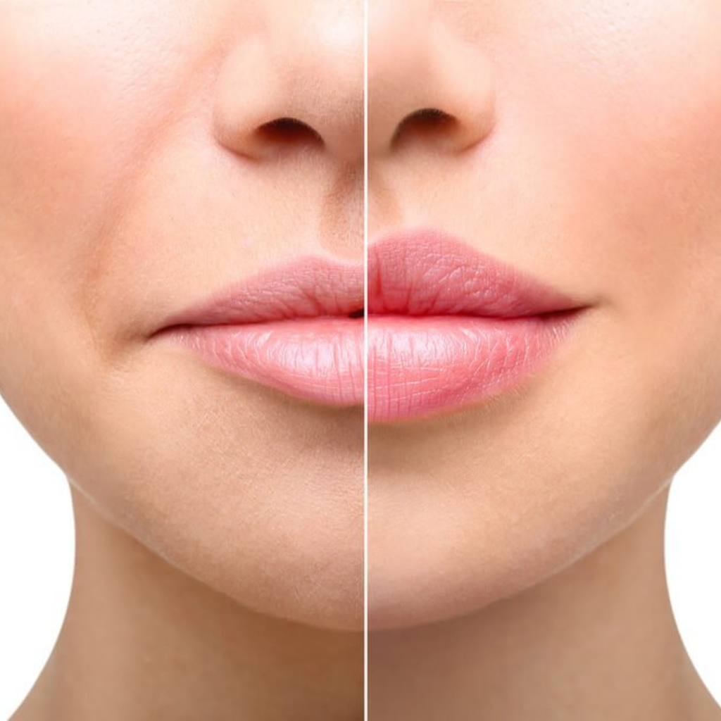 Blush MediSpa | 950 Bend Ct, Coquitlam, BC V3J 7S2, Canada | Phone: (604) 619-0316