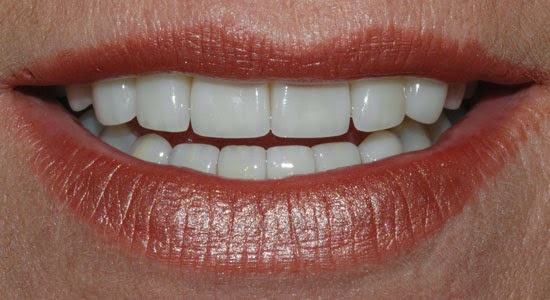 Second Nature Dental Innovations | 620 Alden Rd, Markham, ON L3R 9R7, Canada | Phone: (905) 752-0144