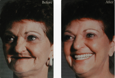 Smile Dental Implant Center - White Rock Dentists & Dental Implants | 1959 152 St, Surrey, BC V4A 9E3, Canada | Phone: (604) 531-3344