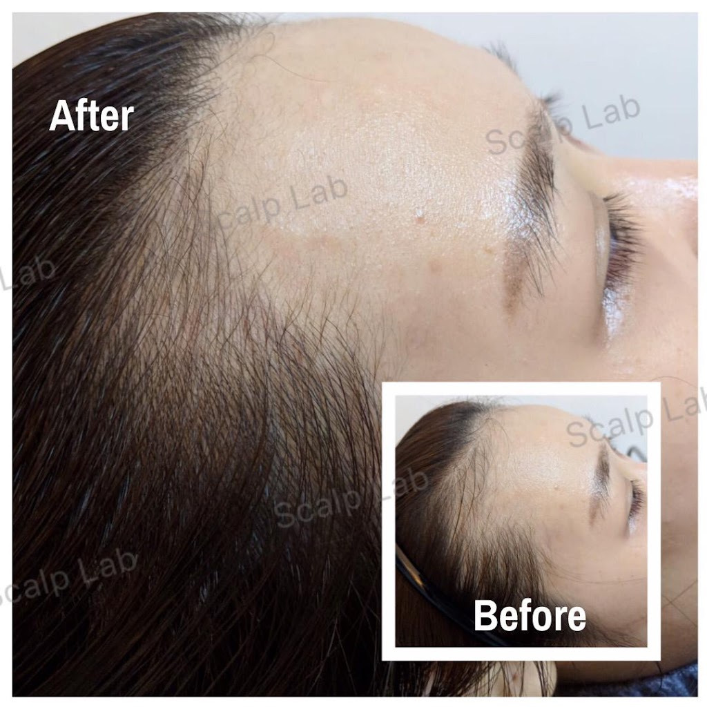Scalp Lab | 135 Village Green Square, Scarborough, ON M1S 0G4, Canada | Phone: (416) 823-9300
