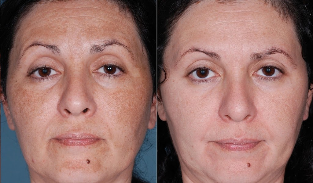 Lasting Touch Skincare Electrolysis & Day Spa | 310 Albert Ave N, Listowel, ON N4W 1T9, Canada | Phone: (519) 291-4444