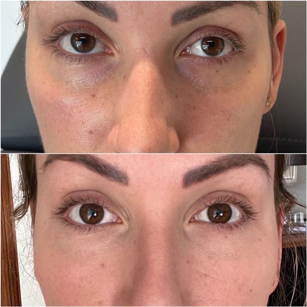 Clinique bē | 2020 Rue André-Labadie local 110, Beloeil, QC J3G 0W6, Canada | Phone: (438) 855-4717