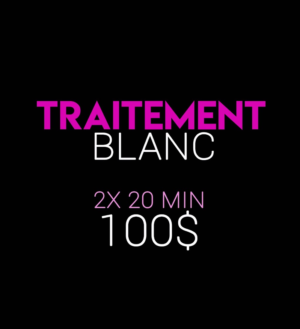 Blanchiment Dentaire rive-sud | 87 suite D, Rue St Pierre, Saint-Constant, QC J5A 1G7, Canada | Phone: (514) 730-8423