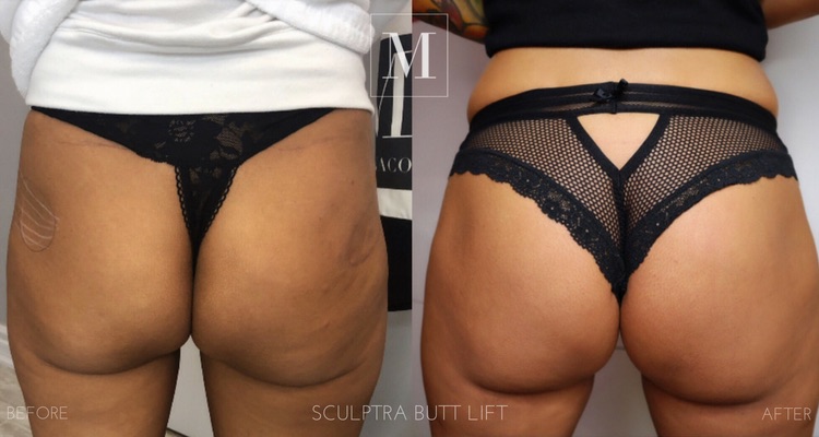 Monaco Medical Aesthetics | 80 King St E, Stoney Creek, ON L8G 1K2, Canada | Phone: (905) 921-4940