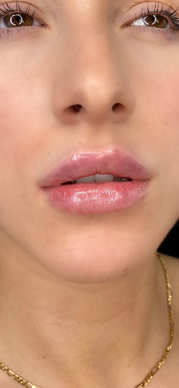 Clinique my face | 5551 Bd Laurier Suite 202, Terrebonne, QC J7M 1T7, Canada | Phone: (514) 980-6228