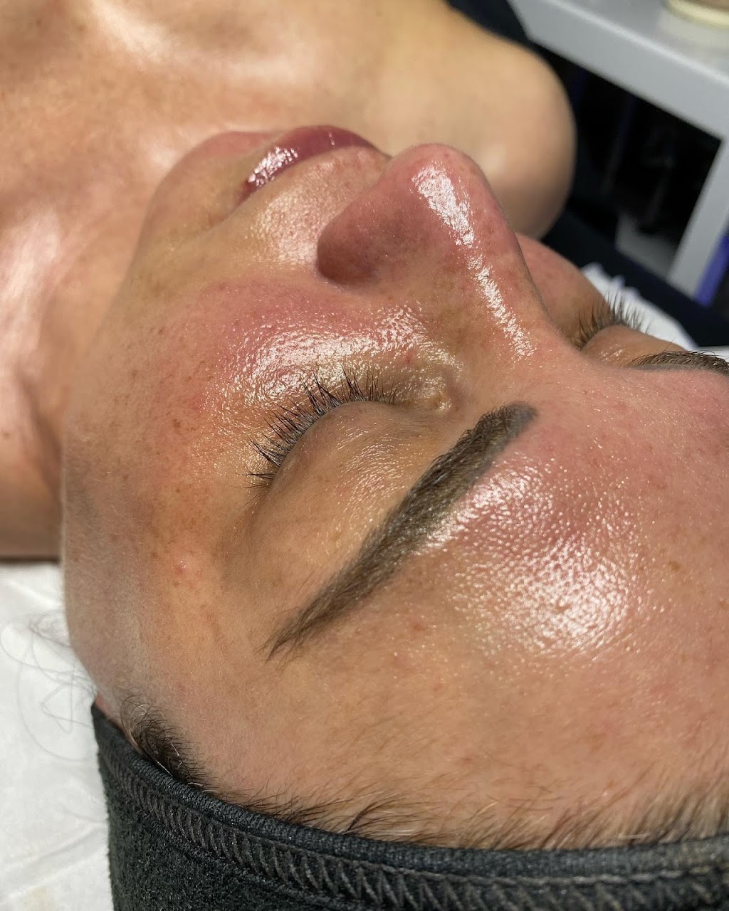 Esthétique Sima - Hydrafacial, Soins du visage | 3471 Rue du Commandant, Laval, QC H7E 0A1, Canada | Phone: (514) 638-7873