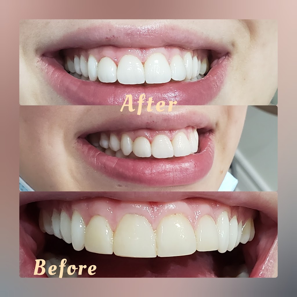 Smile Horizons Dental Arts | 3145 Dundas St W Unit 13, Mississauga, ON L5L 5V8, Canada | Phone: (905) 607-8778