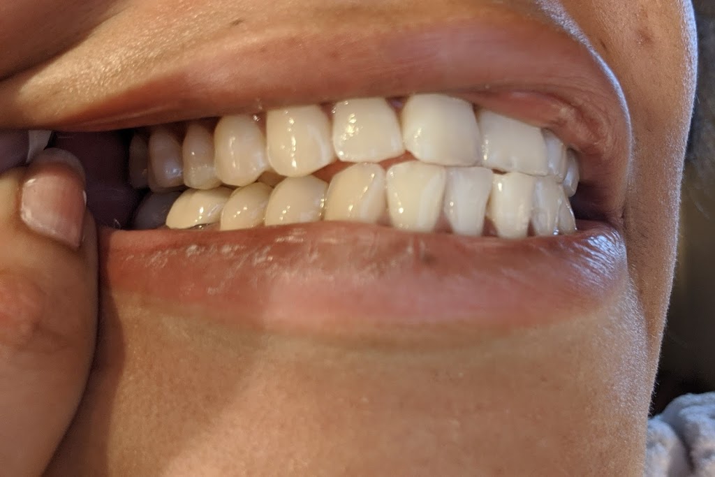 Avenue Dental Centre | 141 Sheppard Ave W, North York, ON M2N 1M7, Canada | Phone: (416) 222-4488