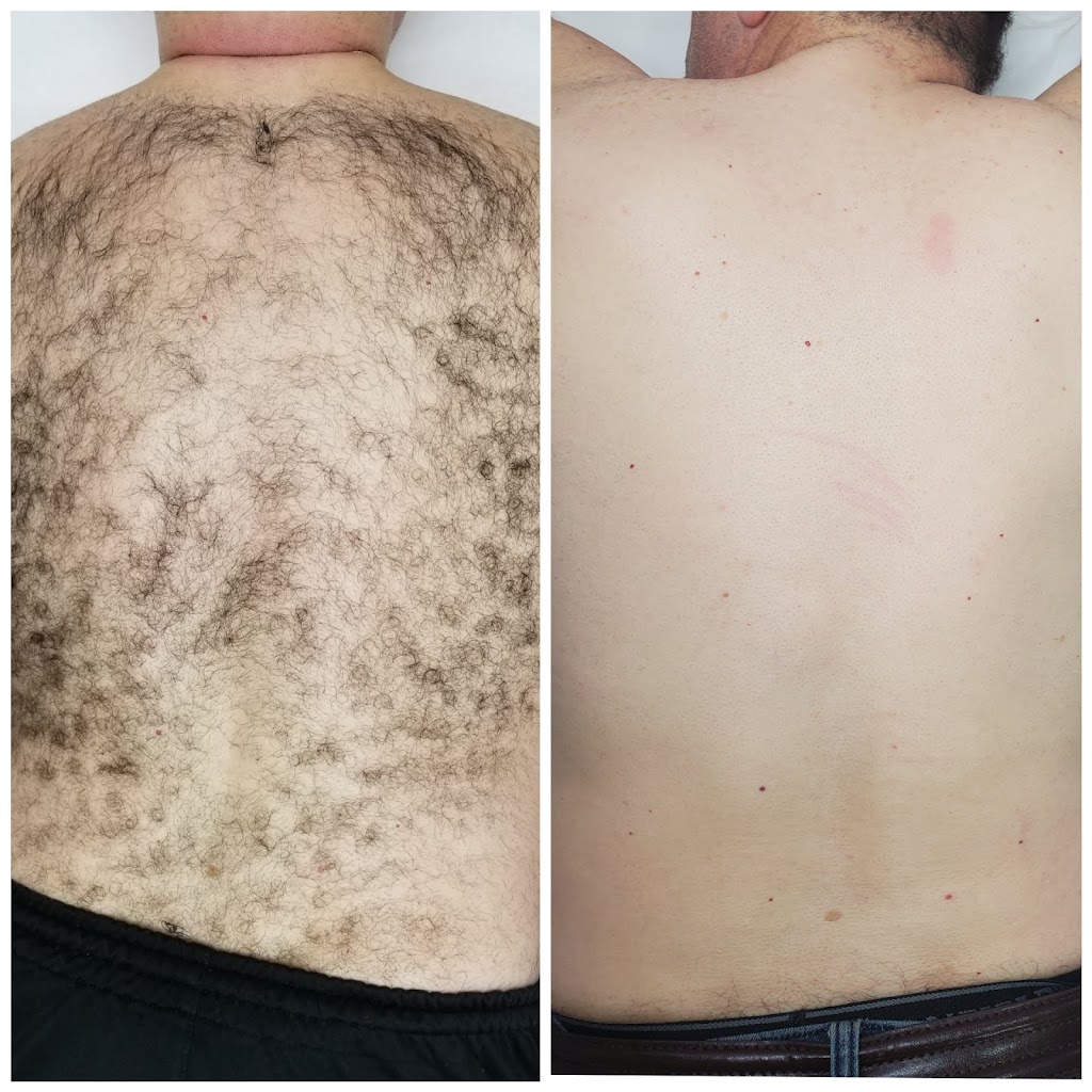 Skin Essentials Laser Clinic | 58 Cathedral High St, Markham, ON L6C 0P3, Canada | Phone: (416) 843-7458