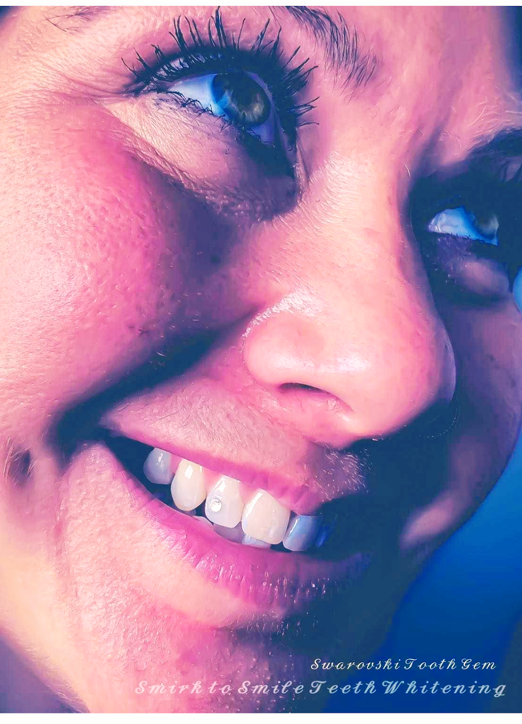 Smirk to Smile Teeth Whitening | 10 Jensen Crescent NE, Airdrie, AB T4B 1P4, Canada | Phone: (403) 404-1421