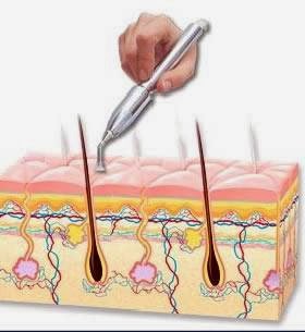 Natural AntiAgeing Clinic | 2601 Matheson Blvd E #15, Mississauga, ON L4W 5A8, Canada | Phone: (905) 629-8088