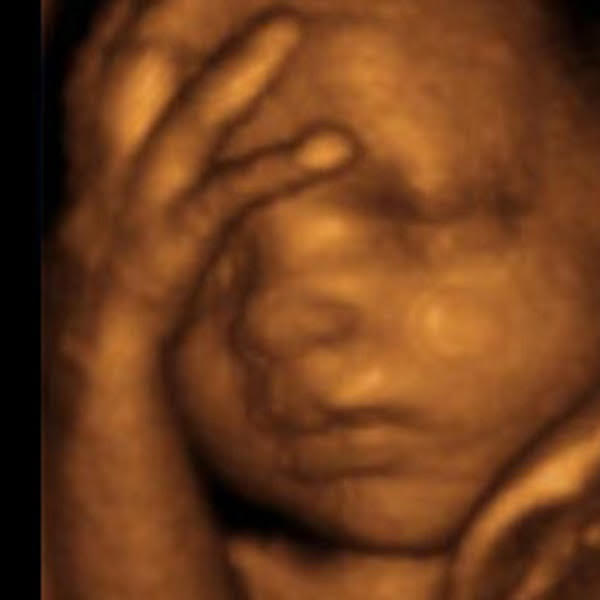 Baby Peek Ultrasound Inc | 28016 Township Rd 540, Spruce Grove, AB T7X 3V4, Canada | Phone: (780) 901-8313