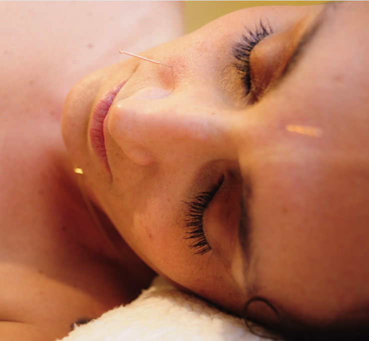 Acupuncture Marylène Fournel - St-Jérôme | 674 Boul. St.-Antoine, Saint-Jérôme, QC J7Z 3B9, Canada | Phone: (450) 504-1113