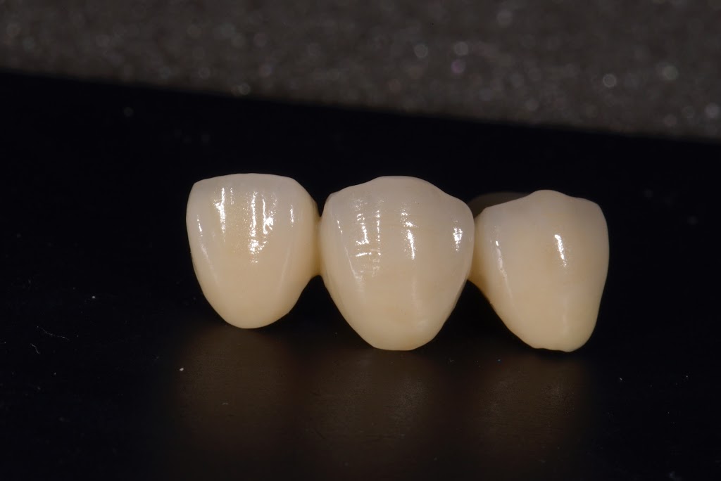 Pacific Skydent Dental Lab Ltd | 702-625 5th Ave, New Westminster, BC V3M 1X4, Canada | Phone: (604) 549-9922