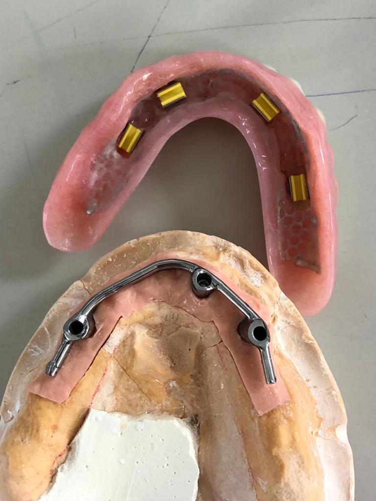 Innovative Dental Laboratories | 1706 Danforth Ave, Toronto, ON M4C 1H8, Canada | Phone: (416) 463-3138
