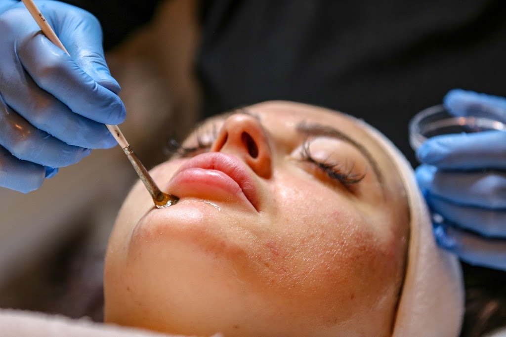 The Skin Klinic | 73 Warren Rd #100, Toronto, ON M4V 2R9, Canada | Phone: (647) 439-3806