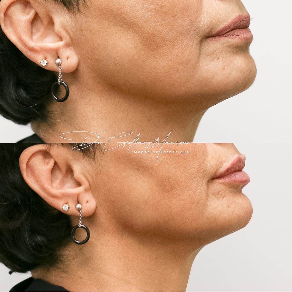 Clinique Esthétique HoMa - Dr. Golbarg Mansour | 4514 Rue Sainte-Catherine E, Montréal, QC H1V 1Y5, Canada | Phone: (514) 500-5805