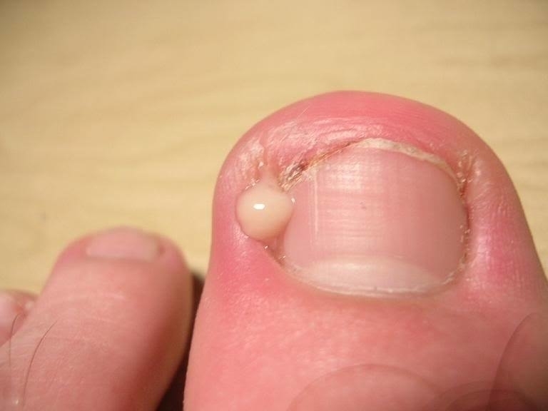 Footloose Footcare Ltd | 200 Rue du Portage, Memramcook, NB E4K 3Y3, Canada | Phone: (506) 381-7238