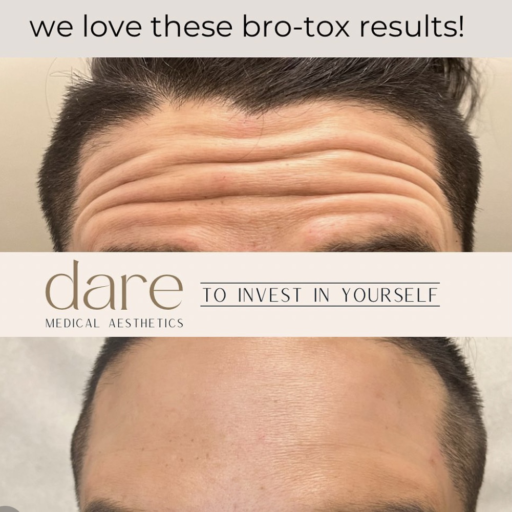 Dare Medical Aesthetics | 10003 24 St SW, Calgary, AB T2V 5K3, Canada | Phone: (403) 873-7734