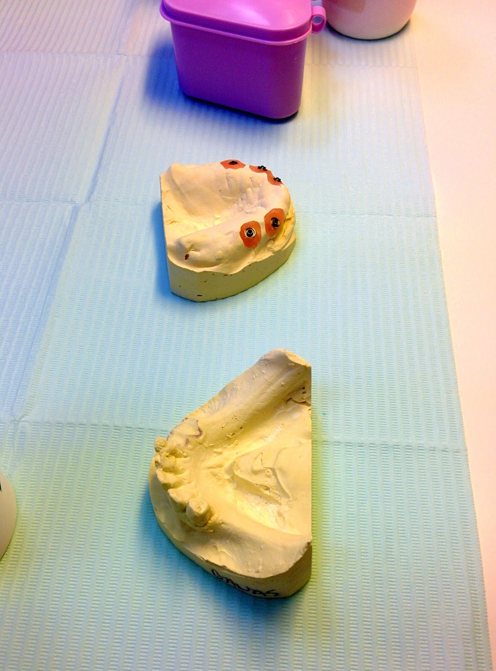 Lima Denture and Implant Solutions | 797 Richmond Rd, Ottawa, ON K2A 0G7, Canada | Phone: (613) 728-5532