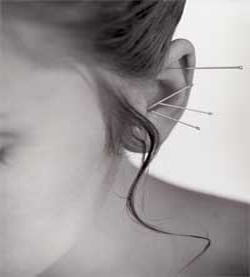 A.D.I.O. Acupuncture & Wellness Center of Buffalo | 704 Beach Rd, Cheektowaga, NY 14225, USA | Phone: (716) 984-0899