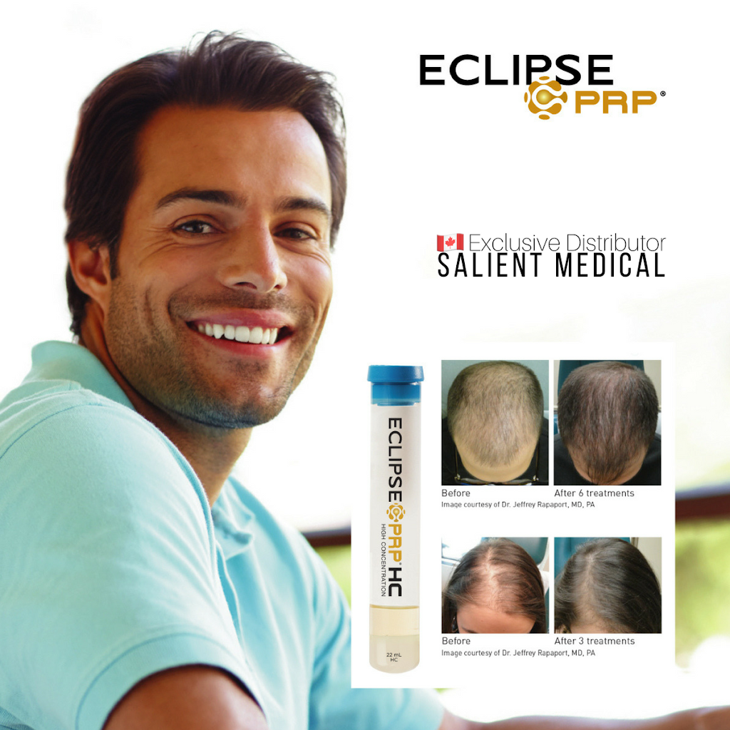 Aurora Hair Loss Clinic | 372 Hollandview Trail unit 302, Aurora, ON L4G 0A5, Canada | Phone: (905) 503-4001
