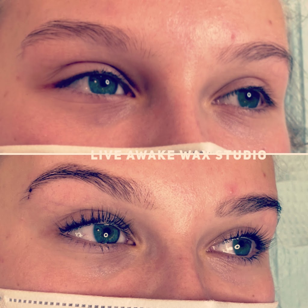 Live Awake Wax Studio & Laser Hair Removal | 20503 42 Ave, Langley, BC V3A 3A8, Canada | Phone: (604) 720-5445
