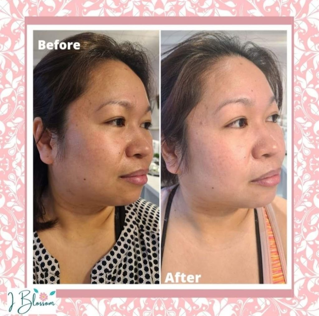 I Blossom Skincare | 119 Nash Rd S, Hamilton, ON L8K 4J8, Canada | Phone: (519) 321-0897