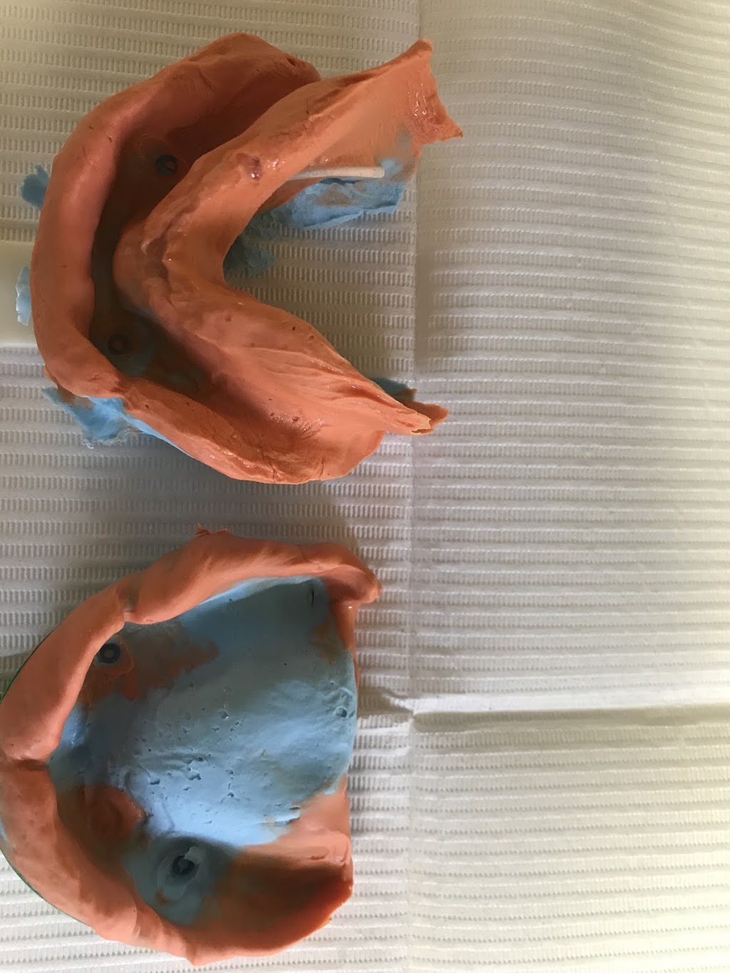 Kasper Denture clinic ltd | 1710 Ellis St Suite 25, Kelowna, BC V1W 3S9, Canada | Phone: (250) 717-3730